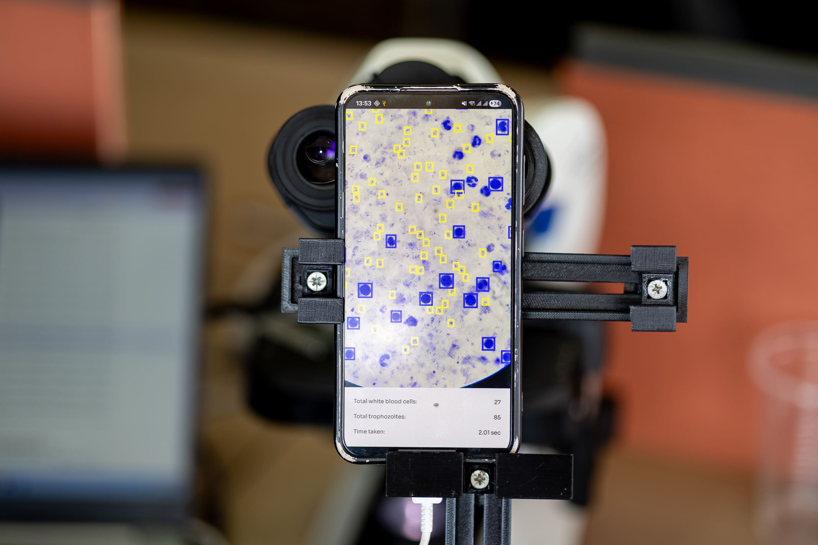 The Ocular smartphone-to-microscope adapter in use