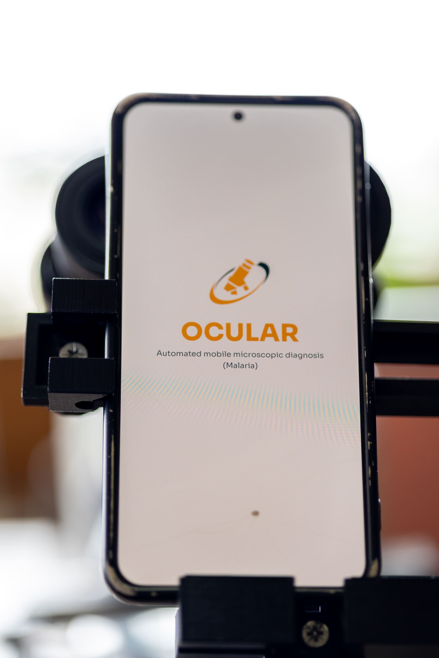Capturing a blood smear image through a smartphone-mounted microscope