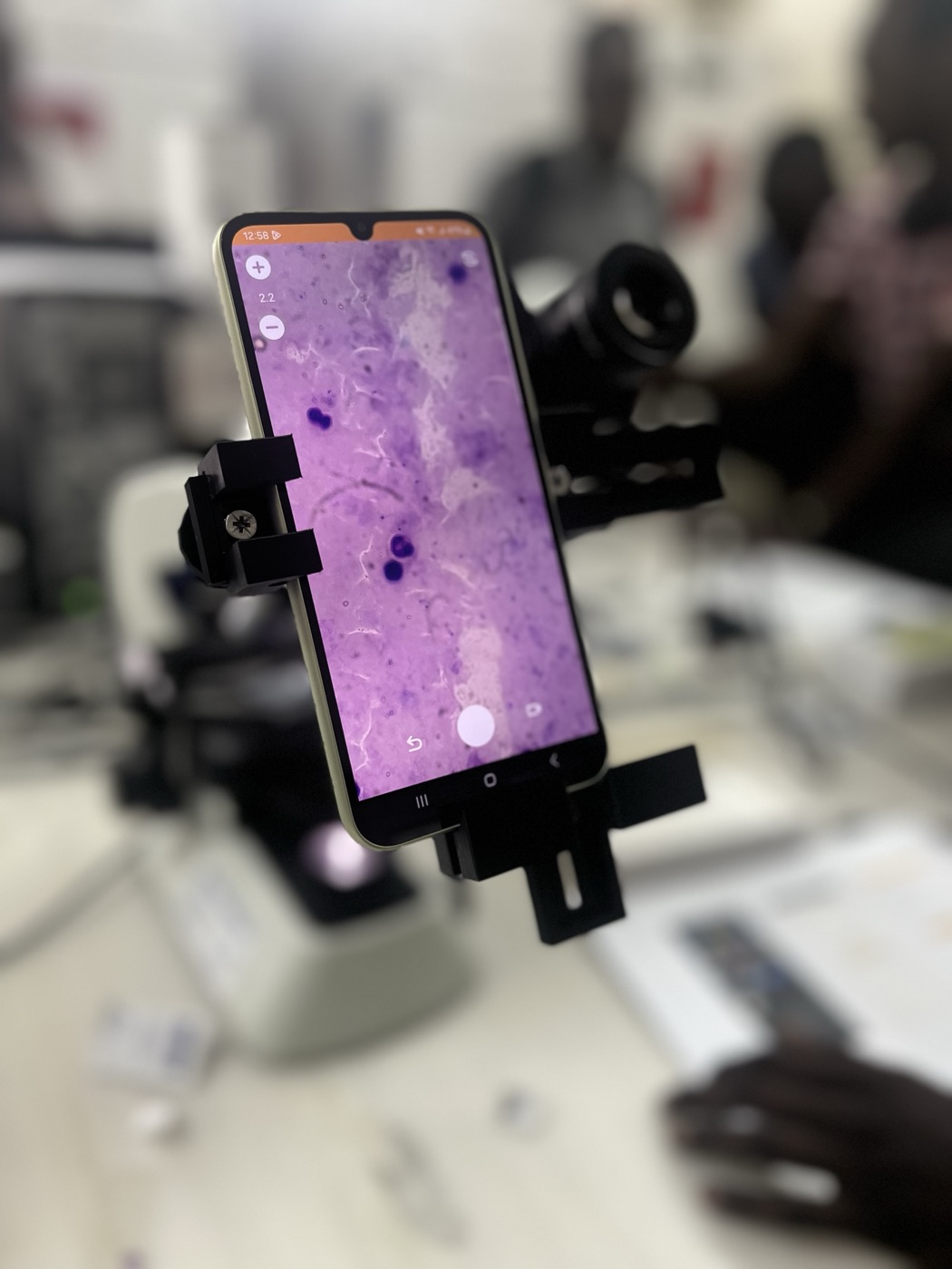 A smartphone held in the Lab's 3D-printed adapter on a microscope, its screen showing a magnified, stained blood smear, while laboratory staff work in the background